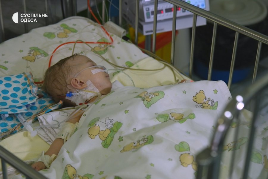 Маленький Гліб після операції на серці.