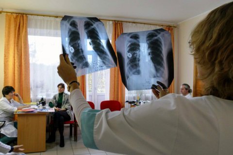 Степанов констатировал резкий рост количества пневмоний в Украине 