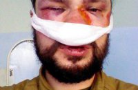 Охорона офісу ПР сильно побила фотокореспондента, йому зламали ніс