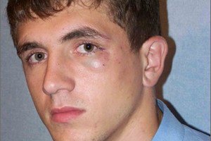 Порушено справу у зв'язку з побиттям кандидата від "УДАРу"