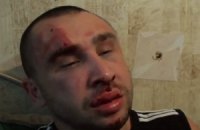 В Донецке напали на журналиста "Дорожного контроля" - сломали челюсть и нос 
