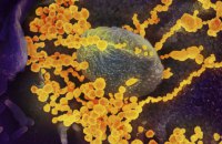 Число інфікованих коронавірусом у світі перевищило 94,7 тис. осіб
