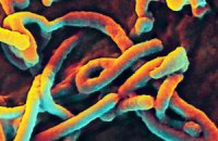 У Росії перевірили 40 пацієнтів з підозрою на вірус Ебола