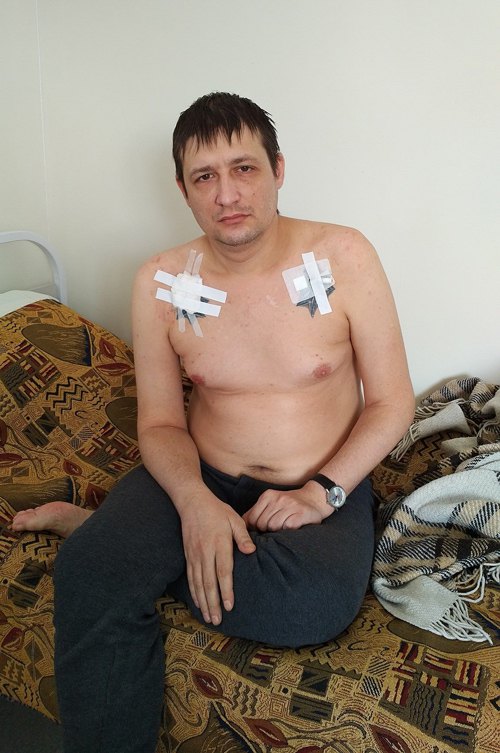 Евгений Танцур на лечении в Харьковском областном противотуберкулезном диспансере