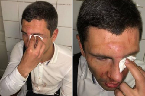 В Киеве избили лидера "молодых ляшковцев"