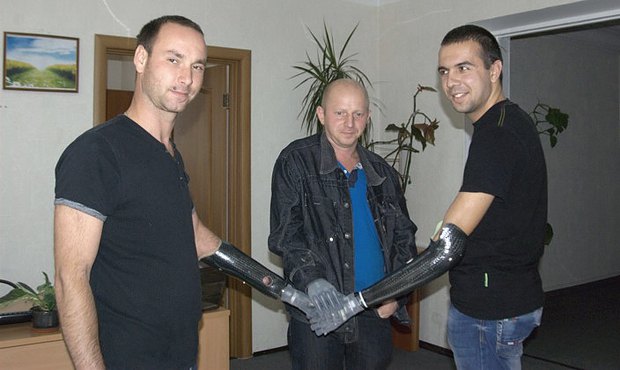 Трьом бійців з України, які втратили руки на війні, в Італії поставили міопротези