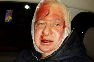 Еще один журналист заявил об избиении "Беркутом"
