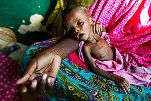 1,4 млн жителів Сомалі потерпають від голоду