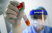 МОЗ відновлює публікацію зведень про коронавірус