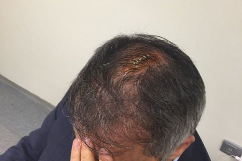 Уболівальники "Фенербахче" розбили голову тренеру "Бешикташа" під час матчу півфіналу Кубка Туреччини