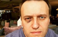 Навальному зробили операцію на оці в Барселоні