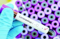 Нардеп Устинова заявила, что Украина собирается проводить тесты на коронавирус системами российского происхождения (обновлено)