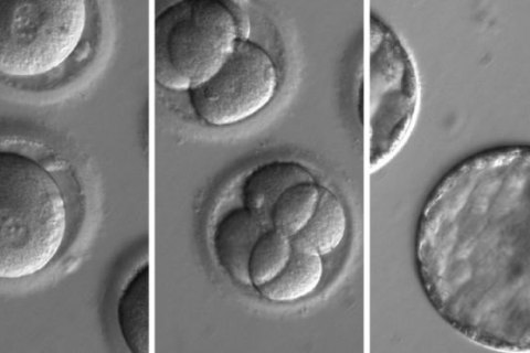 Учені виправили ген людського ембріона