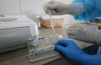ВООЗ хоче забезпечити бідні країни тестами на коронавірус
