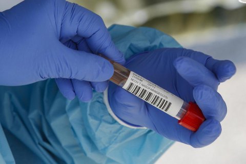 Правительство Чехии обязало компании тестировать своих работников на коронавирус