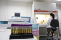 ООН пропонує закрити UNAIDS у 2026 році через скорочення фінансування