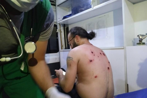 Після розгону мітингу в лікарнях Тбілісі залишаються більш ніж 50 постраждалих