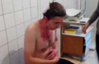 В Олевске избили журналиста, боровшегося против нелегального промысла янтаря