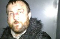Львовского фотографа нашли избитым после задержания на Грушевского