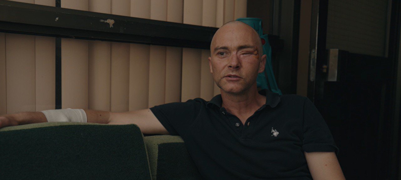 Сергій після операції 