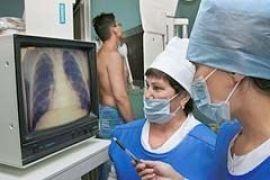 В Украине на 2,5% снизился уровень заболеваемости туберкулезом