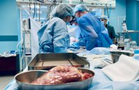 Українцям реально треба робити в десять разів більше пересадок органів, ніж роблять зараз – МОЗ