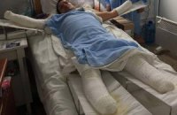 Медикові, який втратив кисті рук і стопи ніг, потрібна допомога