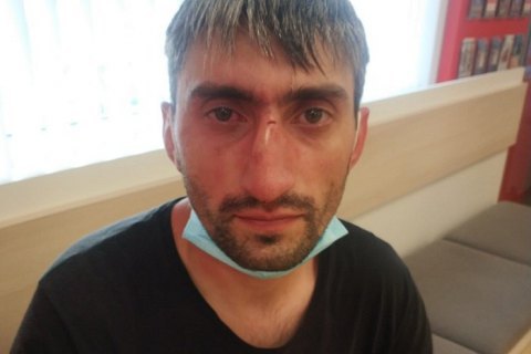 Антимайдановца "Топаза" избили в Киеве 