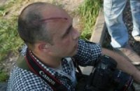 Милиция обвинила избитого журналиста в нападении на "какого-то человека"