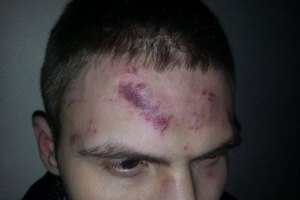 В Киеве неизвестный избил активиста, рисовавшего Януковича с простреленной головой