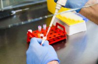 У Житомирі через перезавантаження лабораторії обмежать тестування на коронавірус (оновлено)