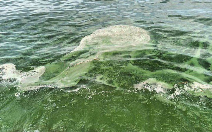 У пробах води на пляжах Одеси виявили небезпечні бактерії 