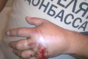 Милиция винит перфоратор в ранении мужчины в футболке "Спасибо жителям Донбасса"