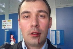 В Житомире избили лидера "Демократического альянса" 