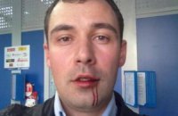 В Житомире избили лидера "Демократического альянса" 