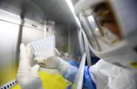 Минздрав: производство тестов на коронавирус в Украине начнется на следующей неделе