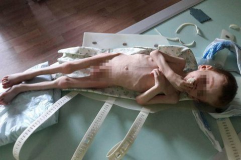 У Новоукраїнці батьки морили голодом 4-річного сина, - ЗМІ
