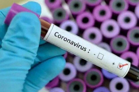 Чоловік із коронавірусом у Київській області перебуває на самоізоляції