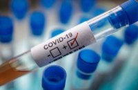 В Україні за добу коронавірус підтвердили у 476 осіб
