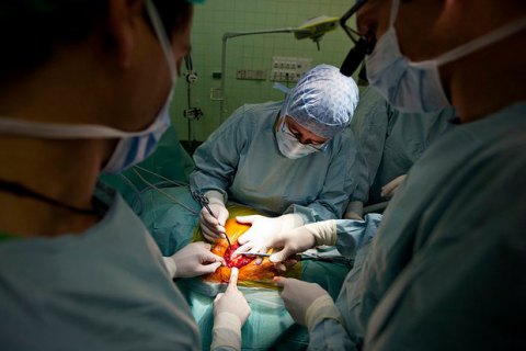 В Україні пересадили друге механічне серце (оновлено)