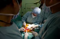 В Украине пересадили второе механическое сердце (обновлено)