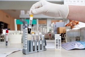 Україна далі потерпає від епідемії кору
