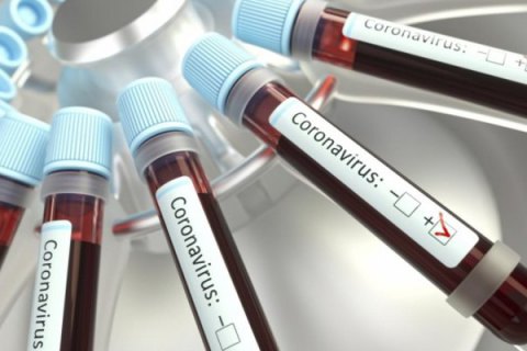В Україні кількість хворих на коронавірус зросла на 109 до 418