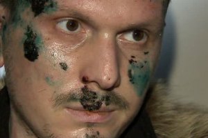 ГПУ: Росія вимагає видати одеського терориста через Кадирова