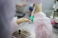 В Украине со следующей недели готовятся запустить массовое тестирование на антитела к коронавирусу 