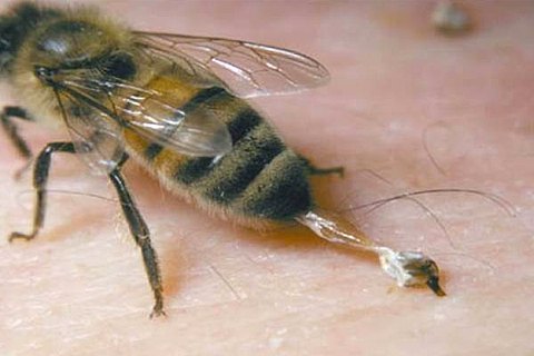 Чоловік помер після укусу бджоли в Харківській області