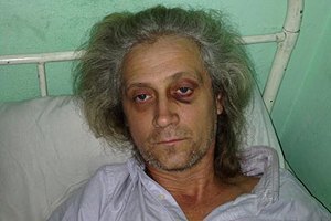 Побитого на Банковій журналіста Гарагуца визнали потерпілим, - адвокат