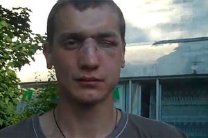 Активисту Гостиного двора разбили челюсть за украинский язык