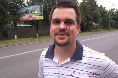 В Луцке избили лидера местного "Нацкорпуса"