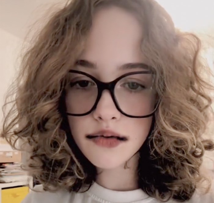 Користувачка соцмереж , яка зробила собі надрізи, скаржиться на біль